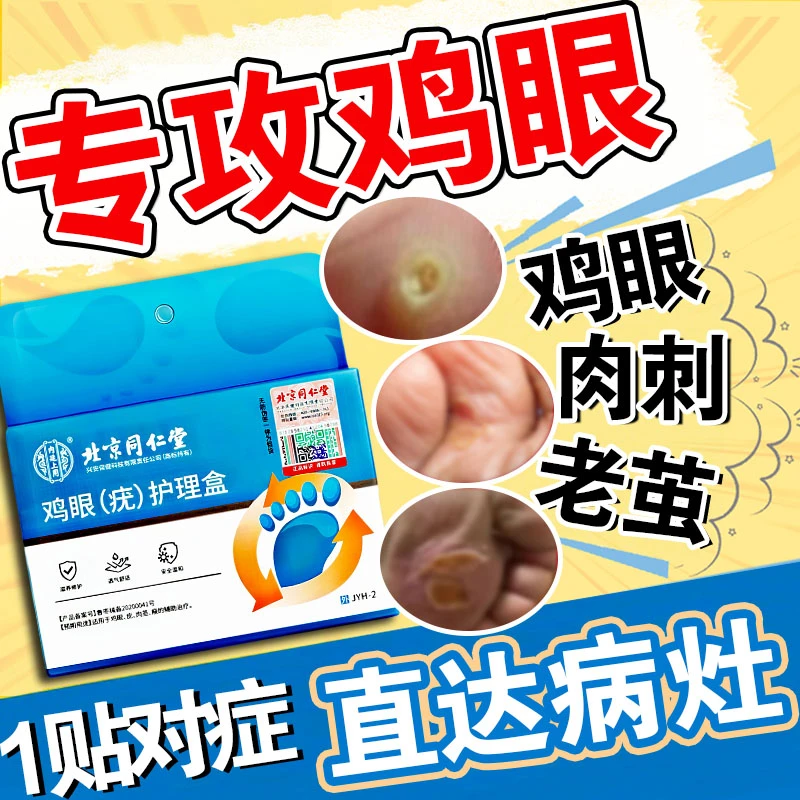 北京同仁堂鸡眼贴鸡眼怎么去鸡眼怎么祛去肉粒疙瘩专用鸡脚眼贴脚上跖疣去手上脚趾脚眼贴肉茧疣瘊鸡眼（疣）护理盒内廷上用