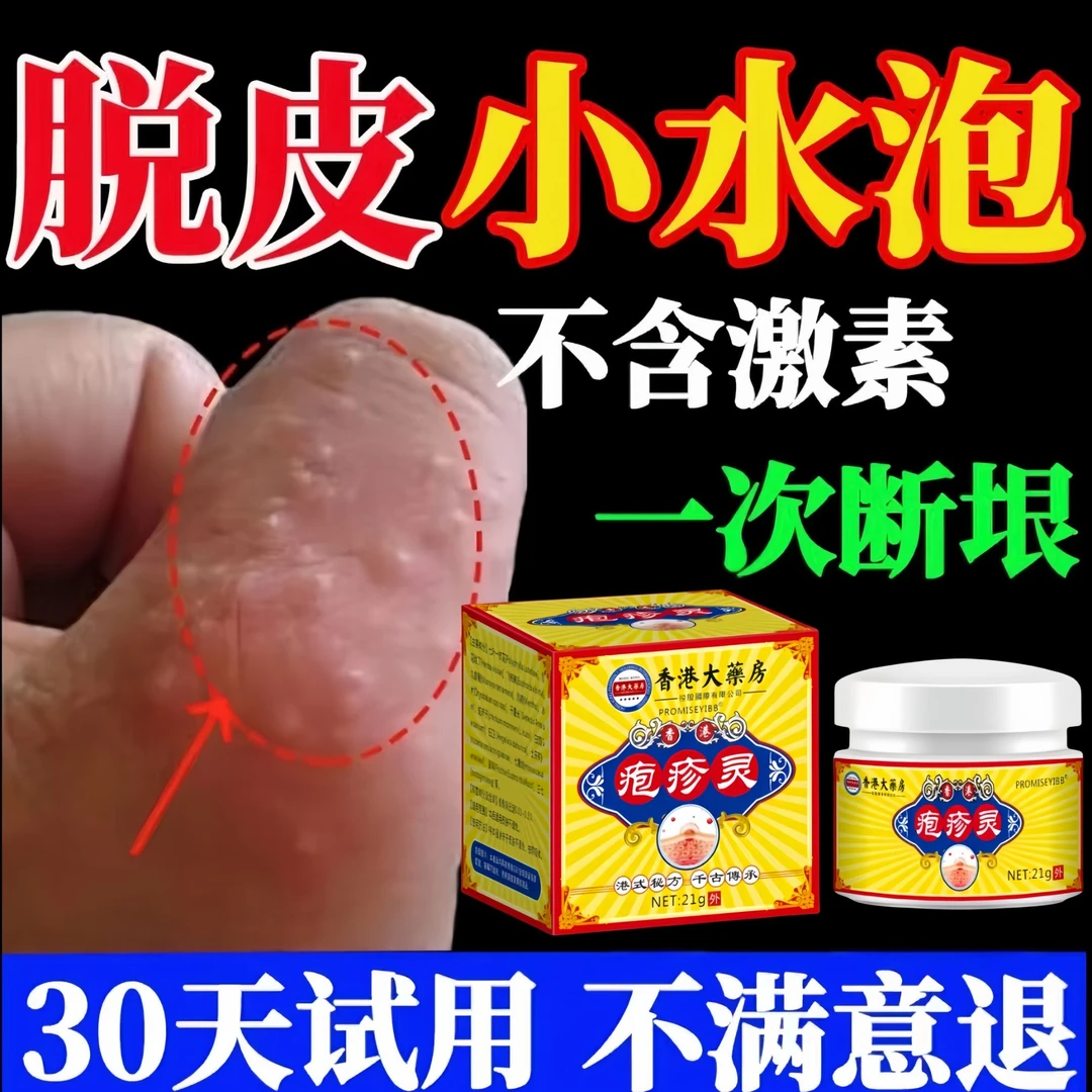 手指上痒起小水泡脱皮干裂止痒克星膏抑菌专用特效正品