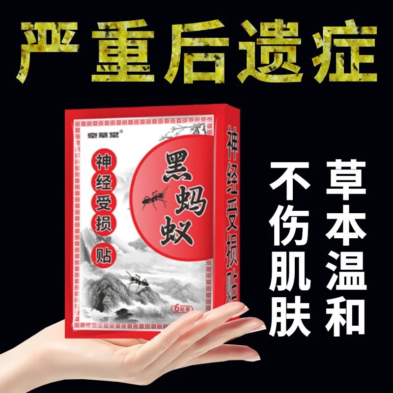 后遗神经痛】带状疱疹后遗神经皮肤痛撕裂火烧痛外用正品黑蚂蚁贴y