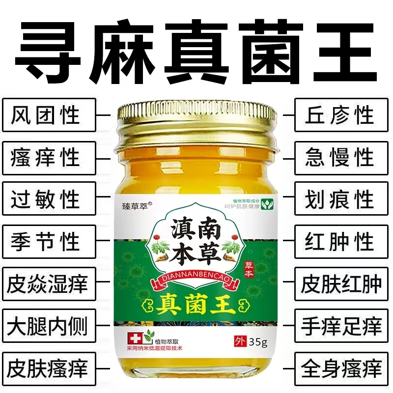 急慢性荨麻诊过敏风团型胆碱性划痕性皮焱湿诊皮肤瘙痒外用止痒膏