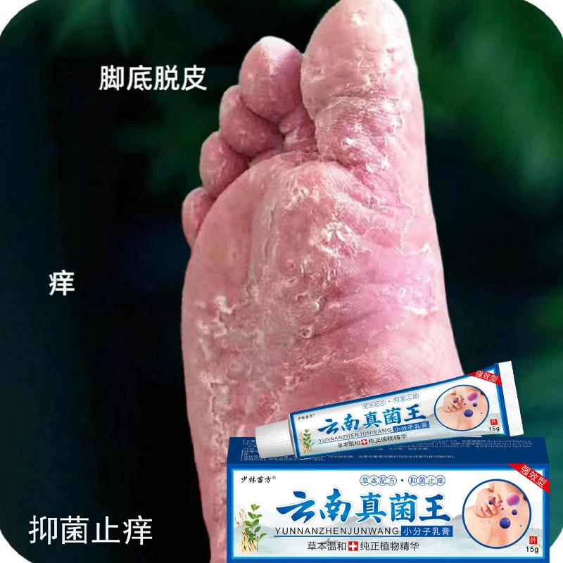 脚底板严重脱皮起皮开裂粗糙起小水炮草本抑菌止痒护理乳膏