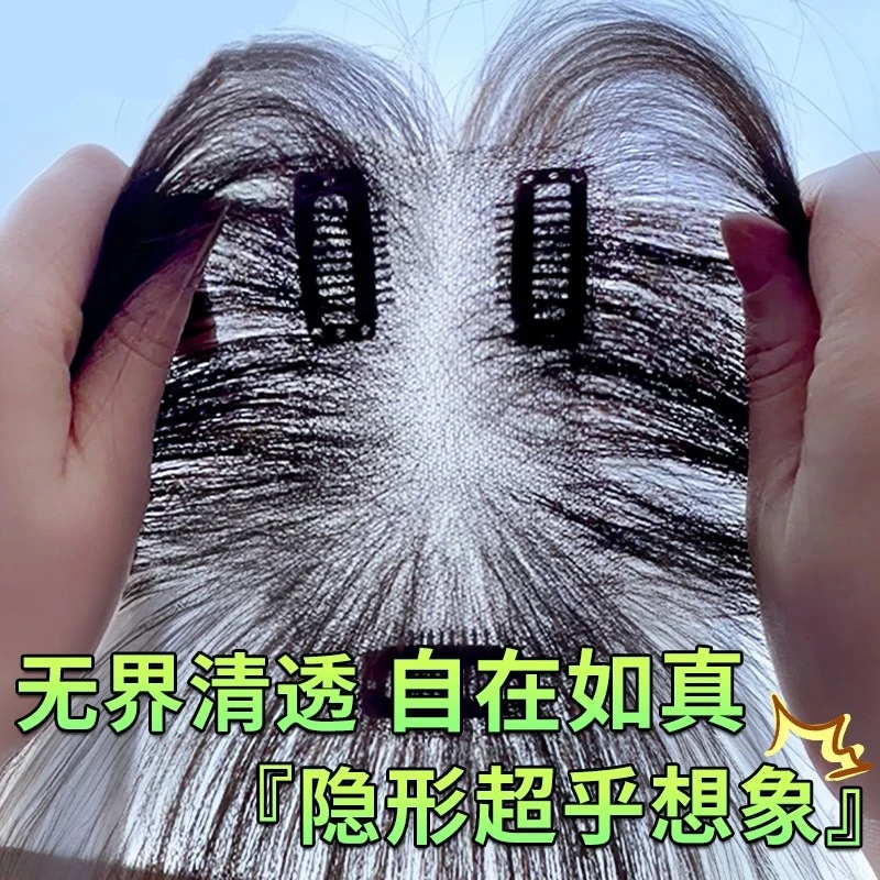 秋季假发片女头顶补发增发量蓬松高颅顶遮白发全真人发真发假刘海