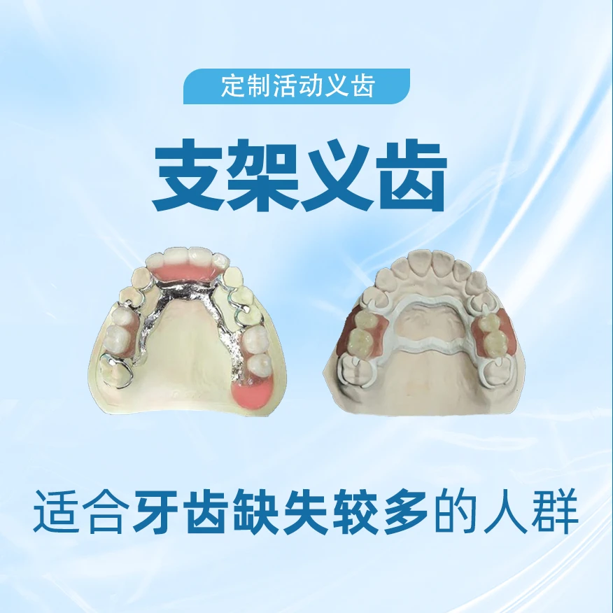 定制活动义齿支架义齿钴铬支架全口纯钛假牙门牙多颗缺失定制