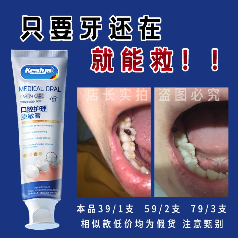 【牙膏界的绝绝子】德国牙膏牙黄黑点点牙龈敏感牙洞大牌牙膏
