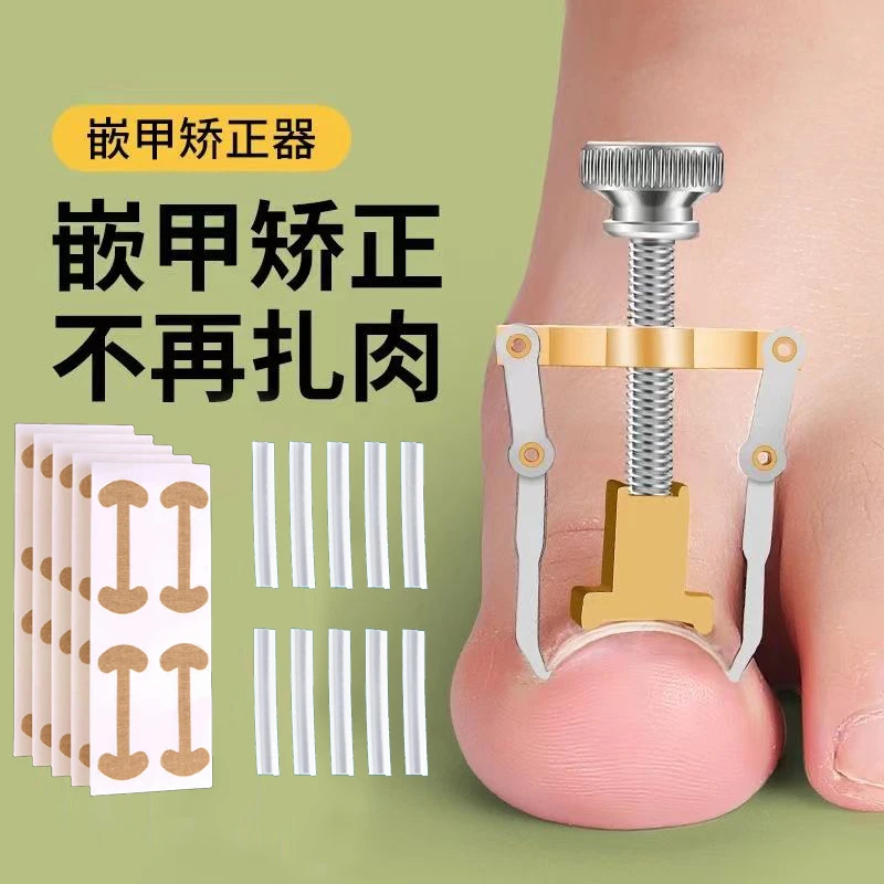 甲沟炎矫正神器嵌甲纠正隔离垫片脚指甲往肉里长趾甲扎肉里正甲贴