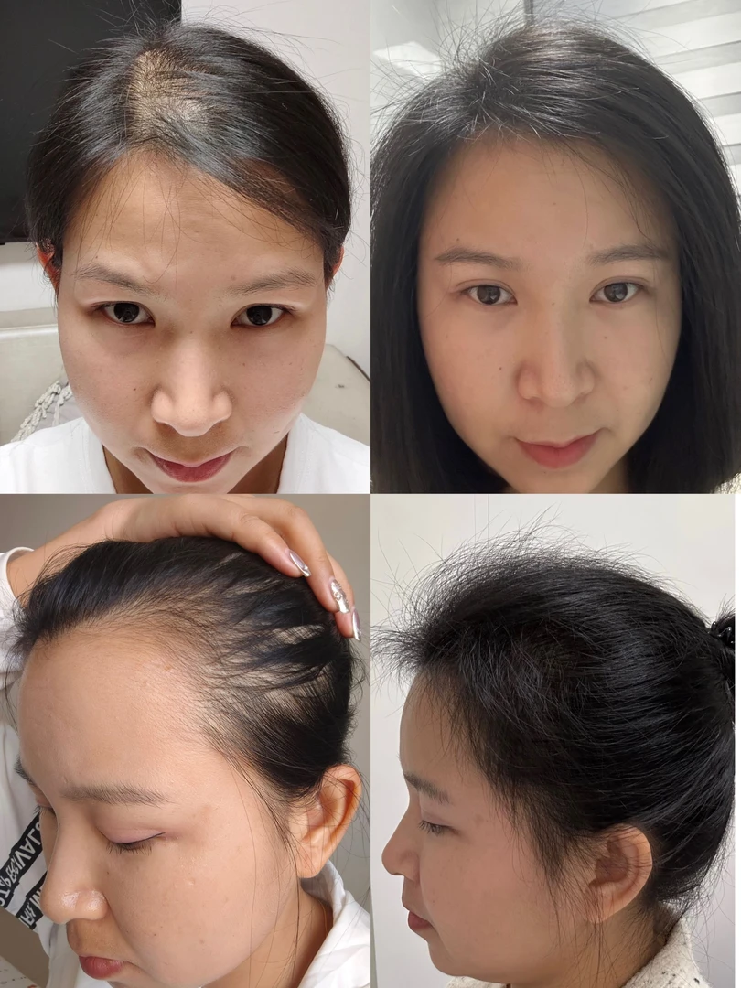 (主播对比图）气垫梳