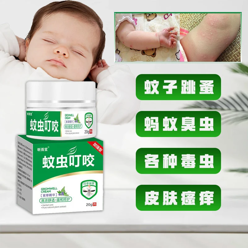 蚊虫叮咬止痒膏消肿毒虫臭虫蚂蚁跳蚤咬成人儿童皮肤快速止痒乳膏