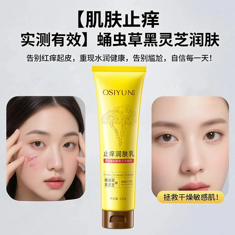 欧丝韵止痒润肤乳保湿滋润秋冬全身干燥皮肤起皮补水身体乳90