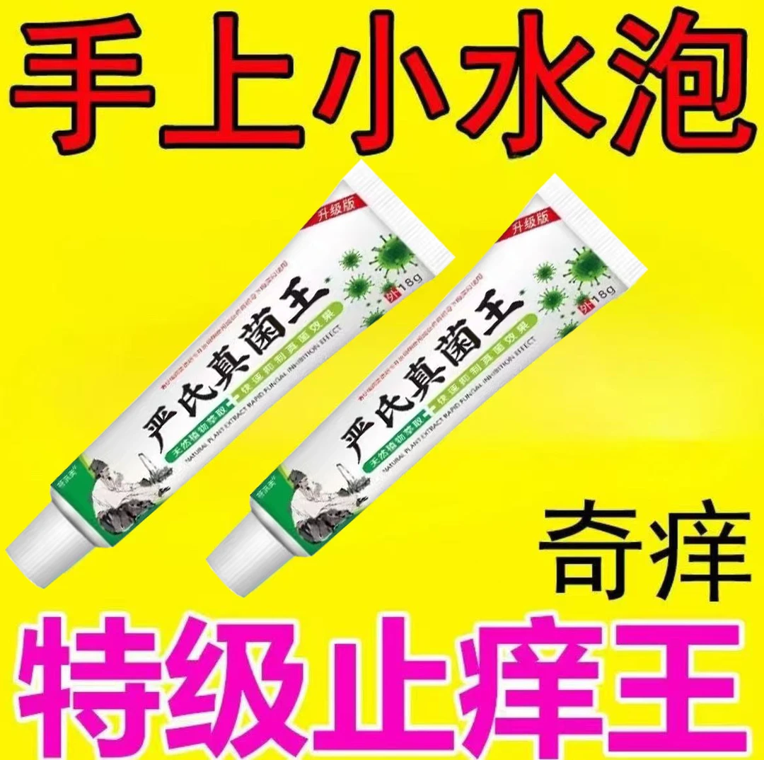 手指头爆皮蜕皮干裂换季手脱皮手心粗糙手脱皮干裂抑菌修复软膏