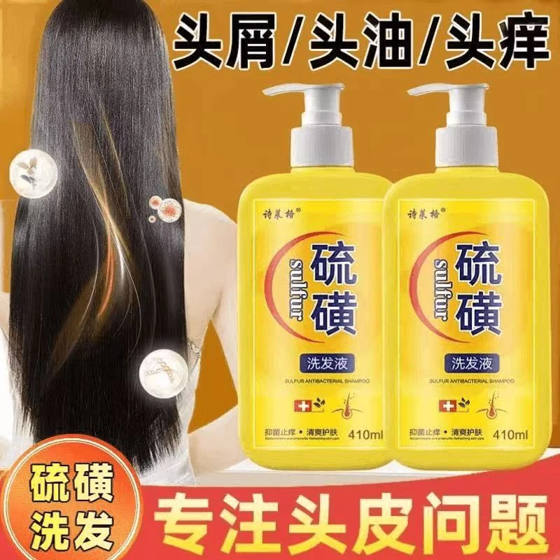 上海硫磺洗发水去屑止痒头皮螨虫毛囊除螨控油通用洗头膏护肤清爽