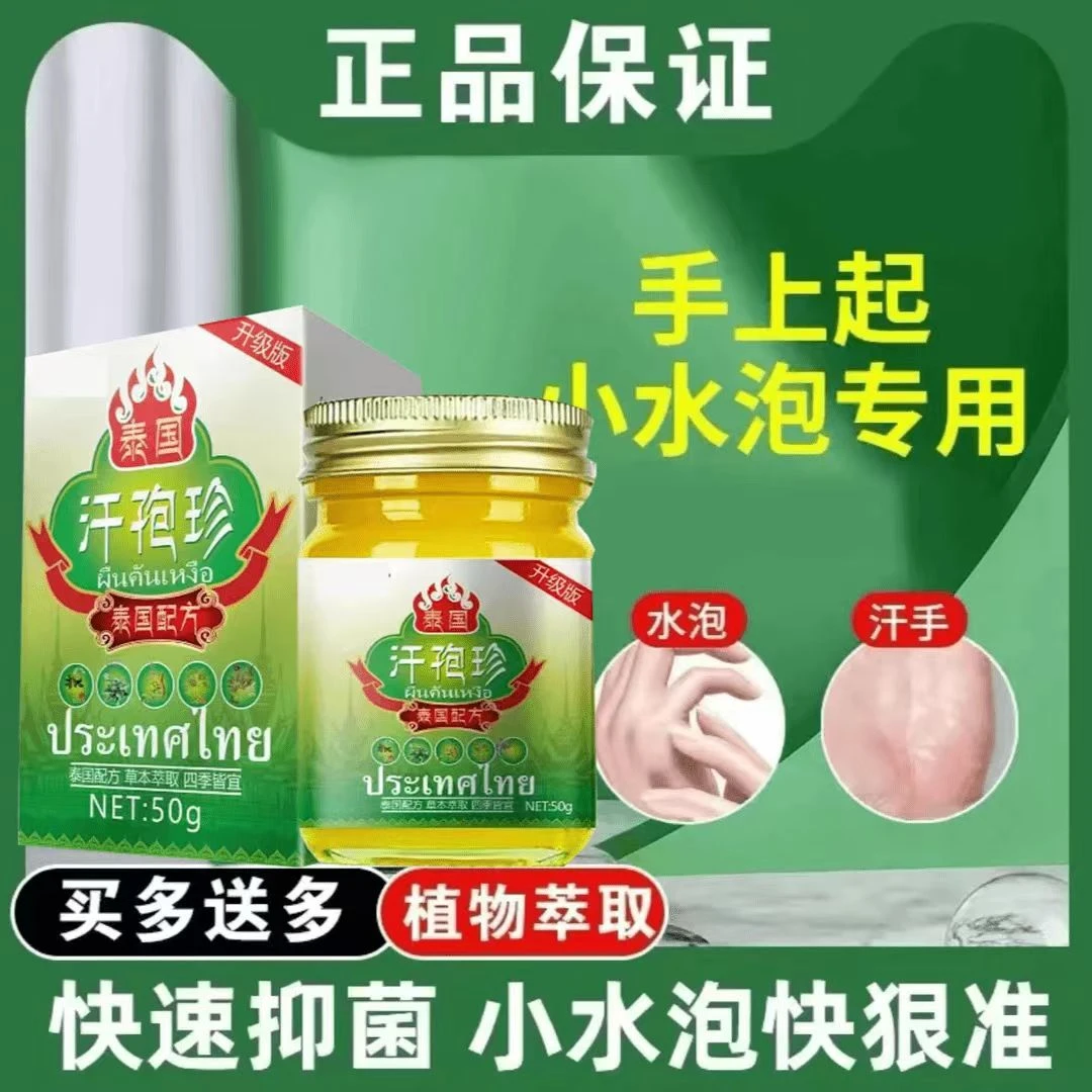 汗萢痒手上小水萢快速止痒手足痒草本萃取温和清凉止痒膏
