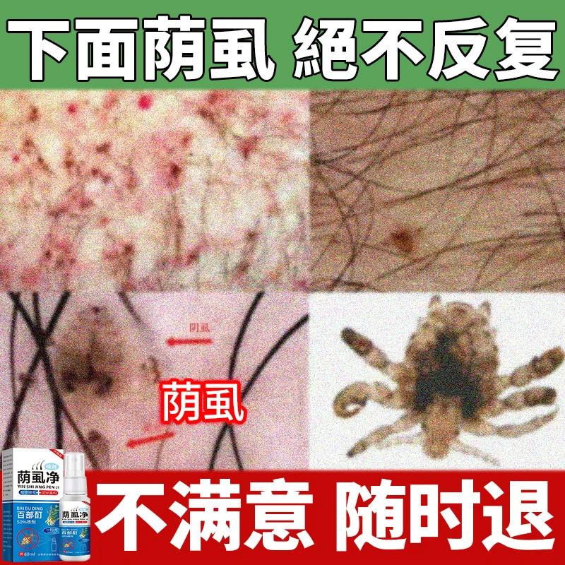 阴虱男士用女全身去虱子正品去除百部酊虱立净去虱卵成人家用喷剂