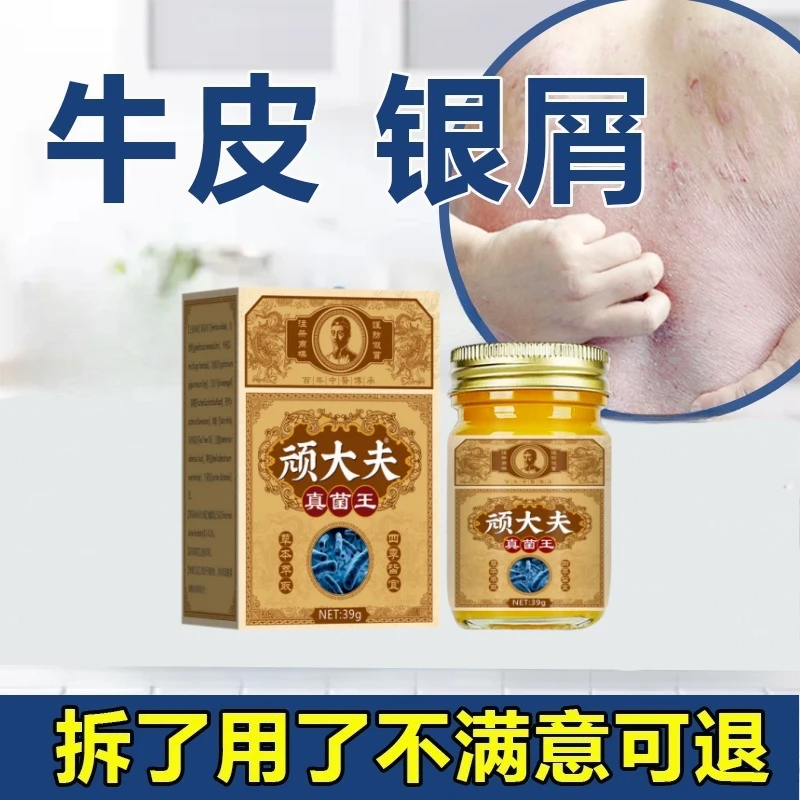牛皮专用膏顽皮止痒膏全身银/屑红点疙瘩皮肤瘙痒外用草本止痒膏