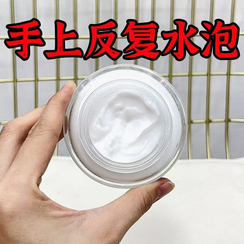 快速止痒皮肤瘙痒干燥全身皮肤手脚干痒强效止痒膏抗菌护理正品