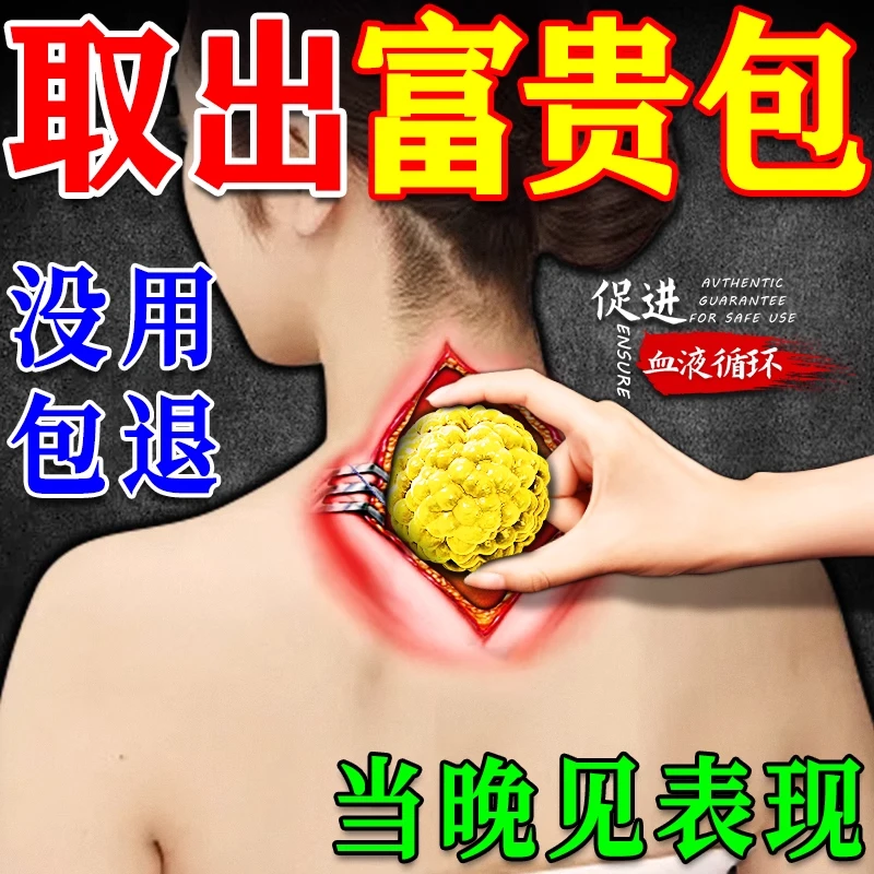 颈椎病富贵包消除贴正品专用疏通神器鼓包大椎穴祛淤堵涨膏药按摩