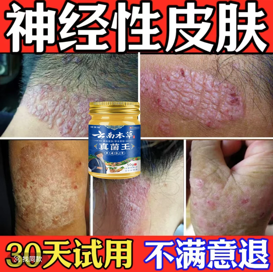 神经性皮肤止痒膏顽固皮手足湿痒抑菌乳膏特效草本修复克星正品