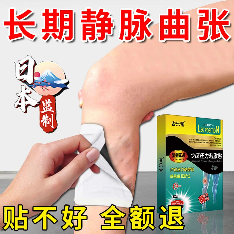 腿部静脉曲张专用膏药贴腿部皮肤下肢青筋凸起疼痛酸胀热敷杏乐堂穴位压力贴