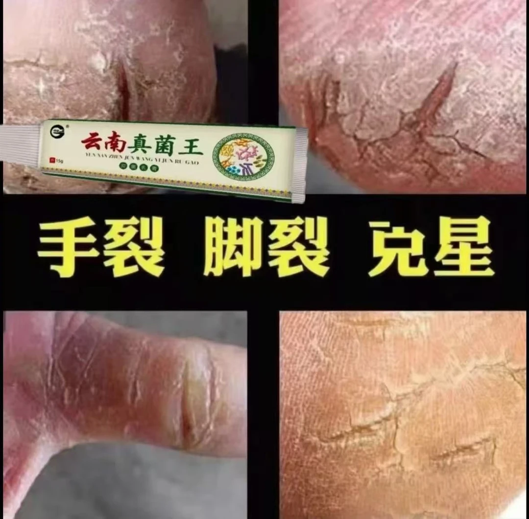 云南真菌王脚后跟开裂专用膏防裂膏手足干裂修复膏保湿粗糙嫩滑