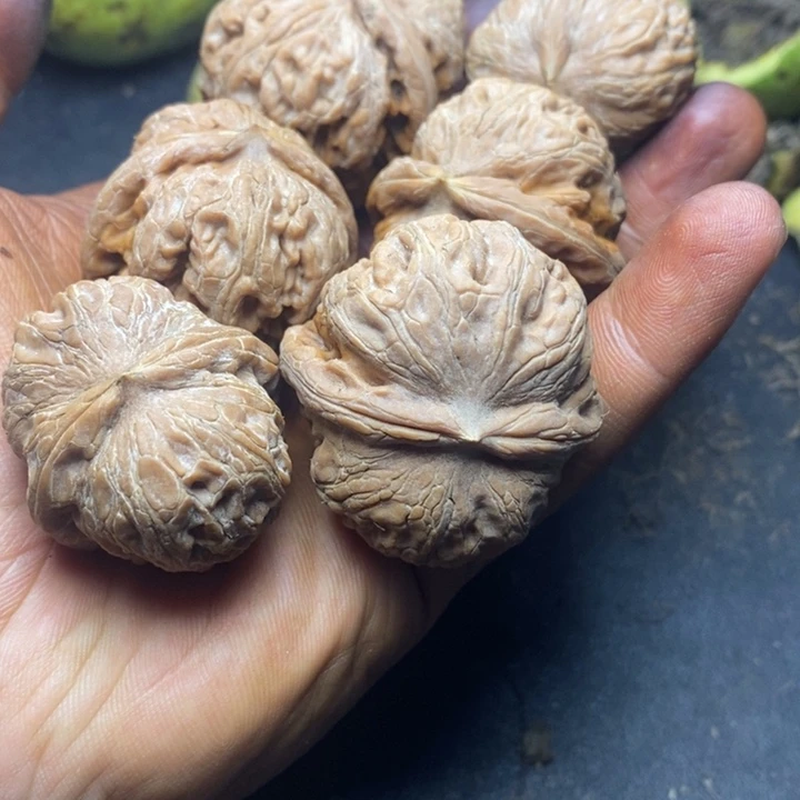 木***s骨质密度居队没问题