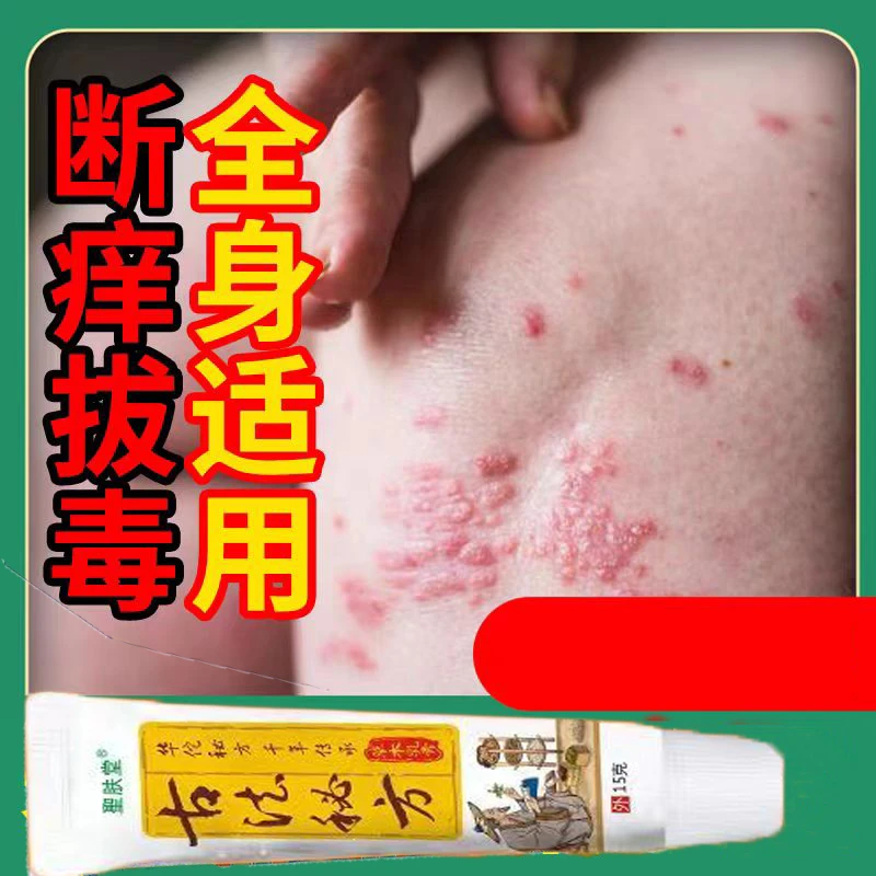 古法秘方杀菌草本止痒膏全身皮肤瘙痒涂抹膏