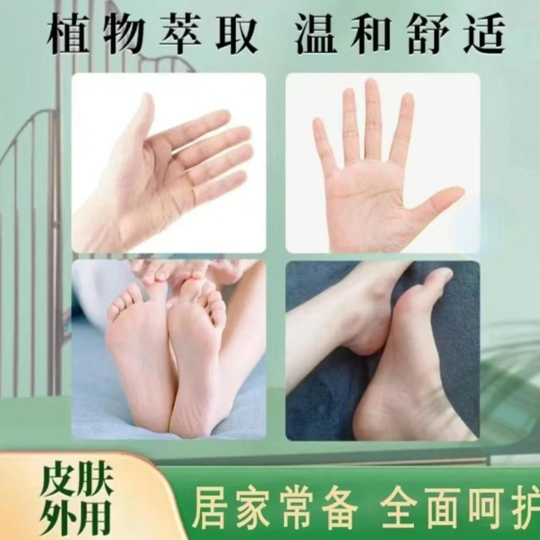 【官方正品】真菌王草本萃取手足部位温和外用膏