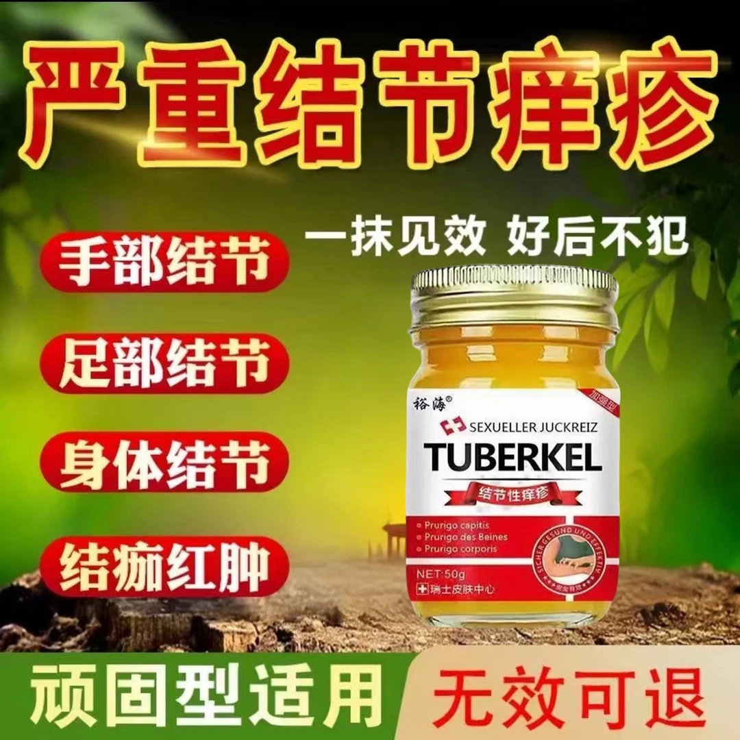 结节性痒疹止痒去硬疙瘩结咔苔癣皮焱湿诊顽固性皮肤外用温和草本