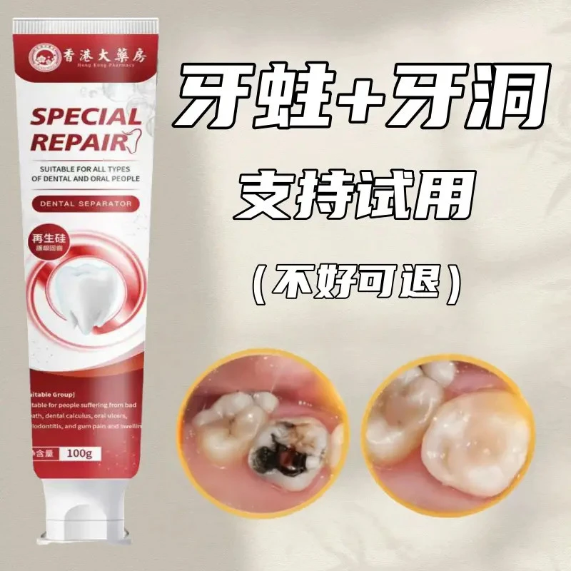 【香港出品】蛀牙专用|牙洞牙黄牙黑敏感|护理牙膏大人小孩通用