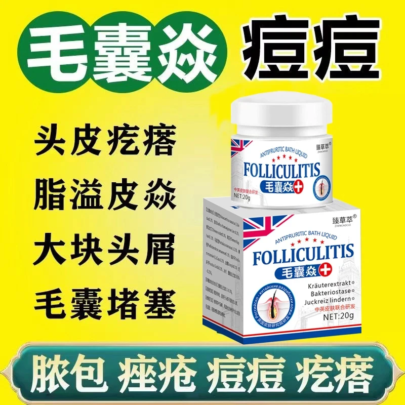 【英国进口配方】毛囊焱严重毛囊堵塞头上后脑勺前胸背部胸部痘痘膏