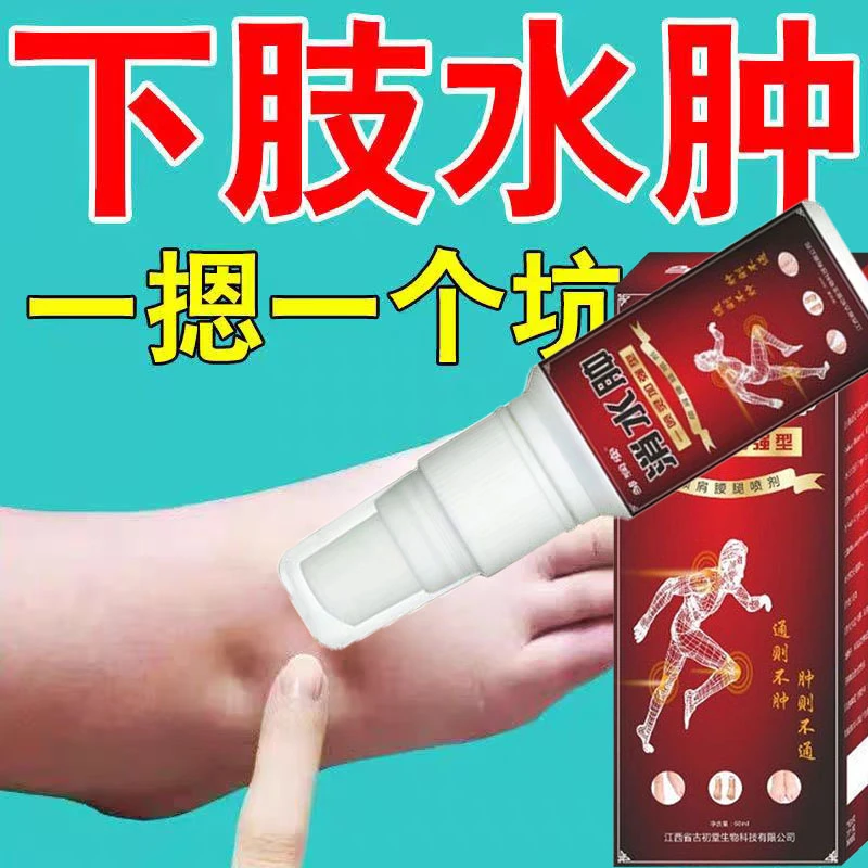 正品老人腿脚水肿喷剂下肢水肿脚肿全身肿穿鞋困难四肢浮肿酸麻