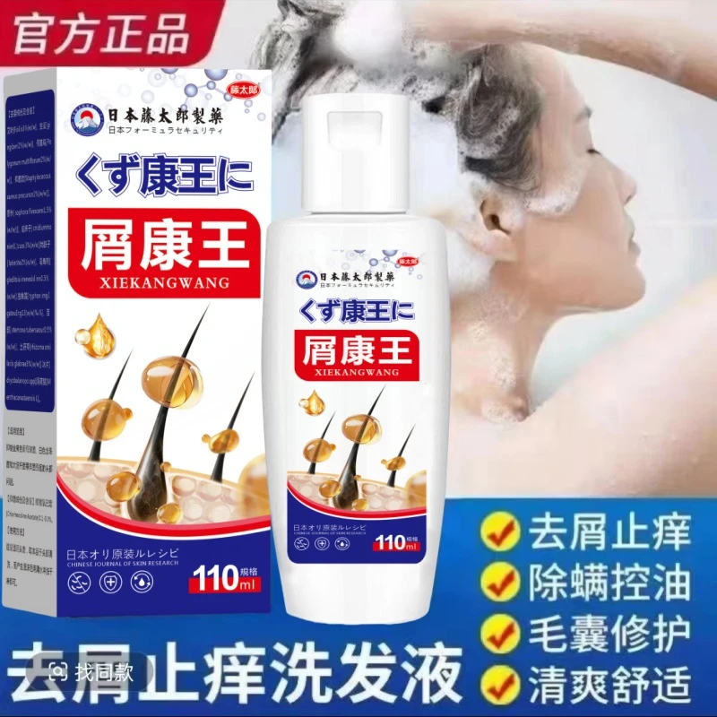 去屑止痒洗发水严重大块头皮屑头痒除螨毛囊控油康主专用洗发露