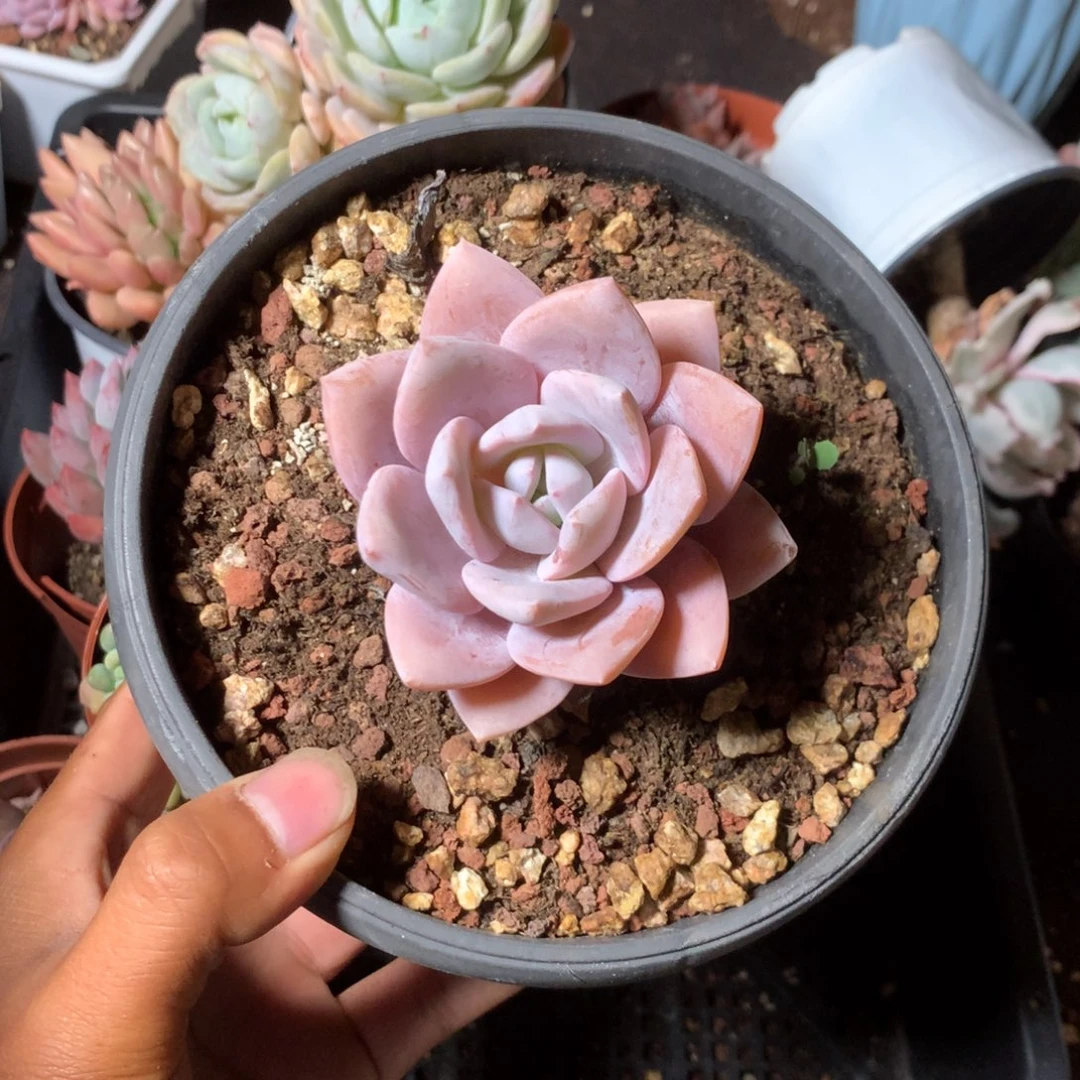 人工关节治疗和各种风湿骨