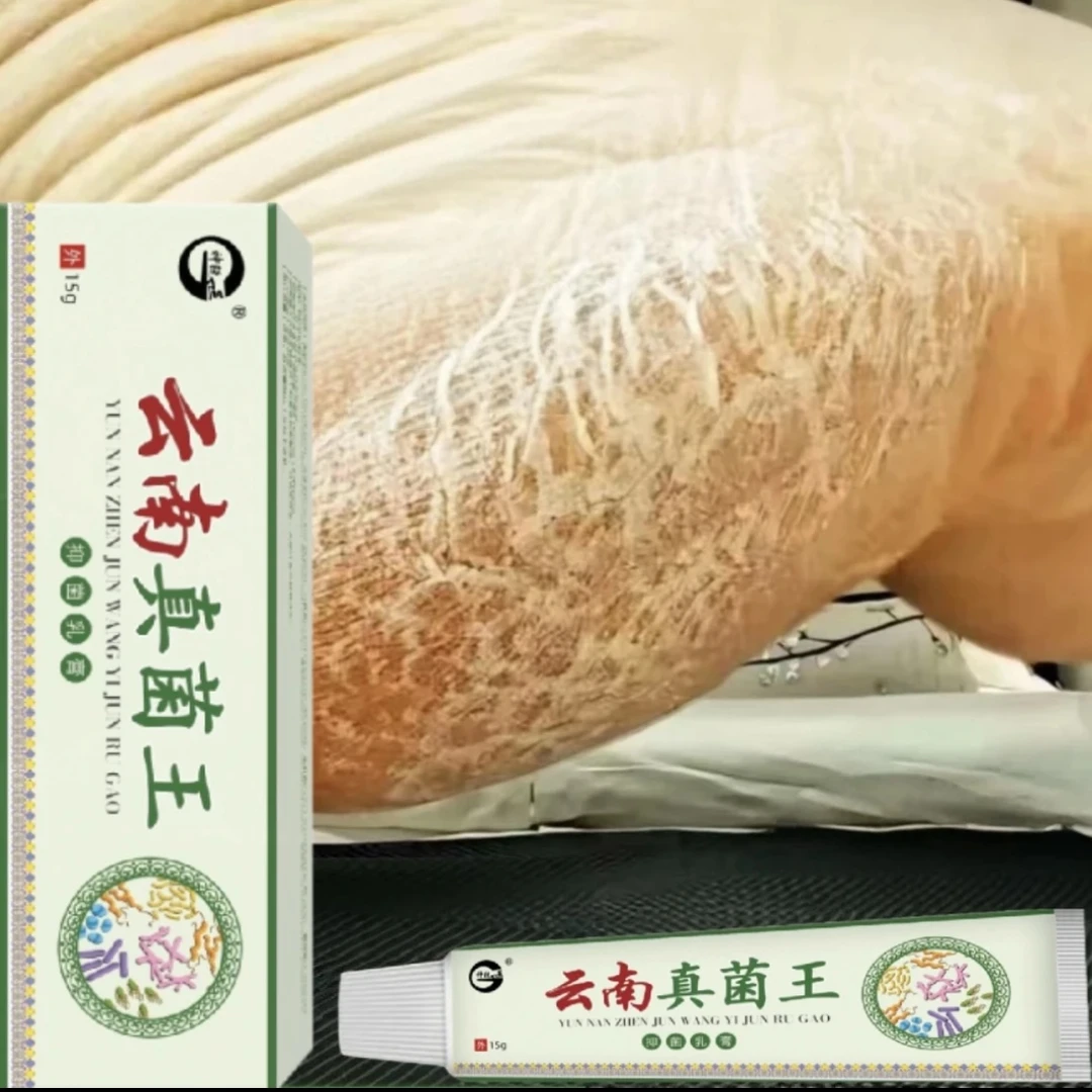 【云南真菌王】脚起皮脚脱皮脚干裂修复膏脚后跟开裂皲裂防裂止痒膏