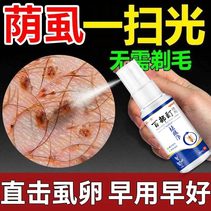 百部酊喷剂虱子虱卵一扫光去除阴虱简单的办法男女去阴虱喷雾正品