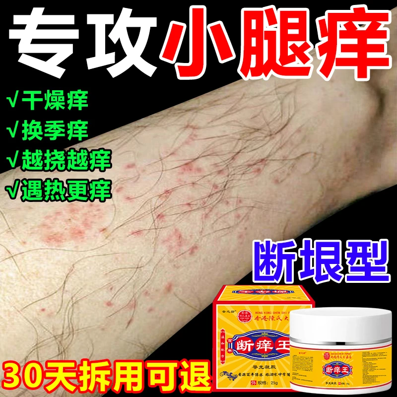 小腿痒腿上干燥起皮肤痒喷剂秋冬腿部瘙痒疙瘩越抓越痒止痒抑菌膏