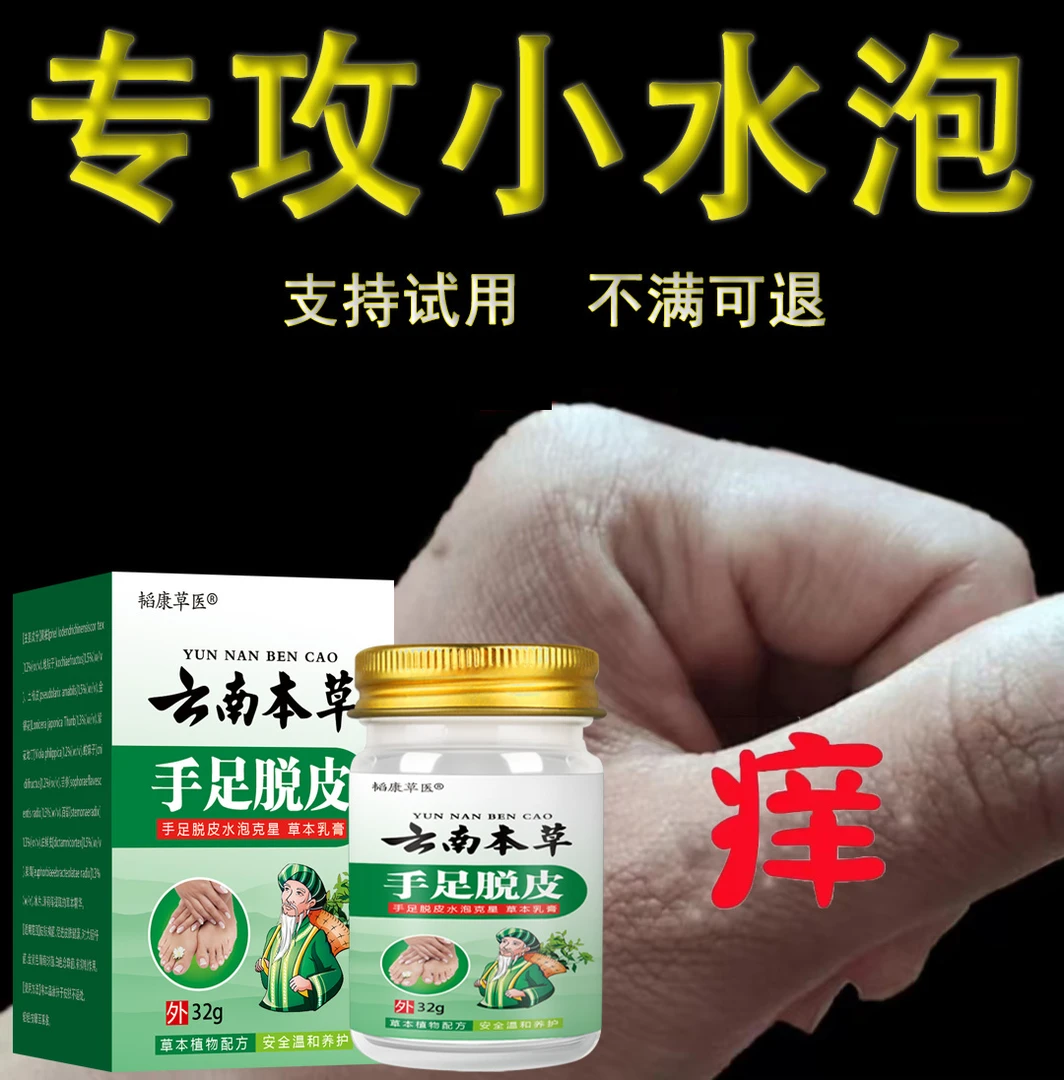 【手脚专用】手上起小水萢止痒膏脱皮手指缝痒干裂专用草本乳膏