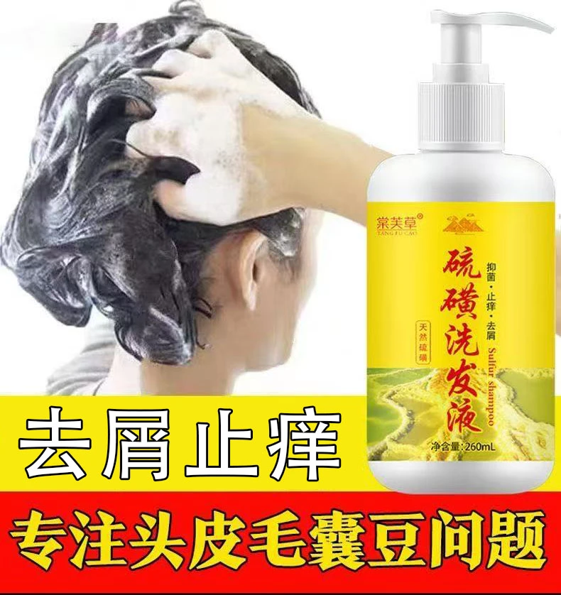 硫磺洗发露去屑止痒头皮毛囊头痒头螨控油洗头膏硫磺皂液体洗发液