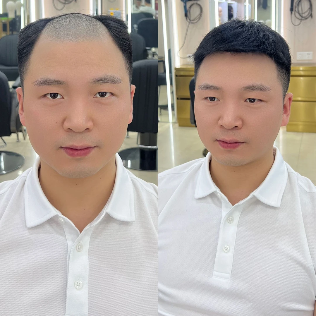 男士假发短发自然真发头顶假发片增发量遮秃顶白发无痕隐形补发片