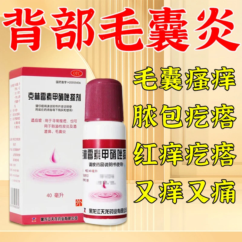 天龙背部毛囊炎脂溢性皮炎毛囊疙瘩红肿脓包 外用药 克林霉素甲硝唑搽剂 40ml