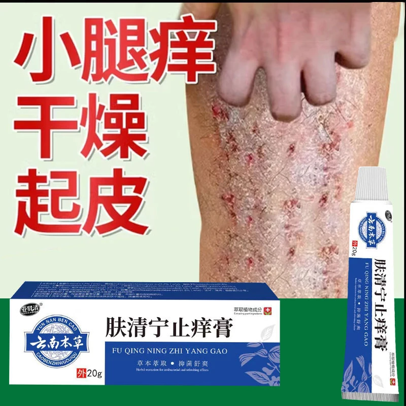 腿上干燥起皮小腿皮肤痒夏天腿部瘙痒越抓越痒止痒抑菌膏