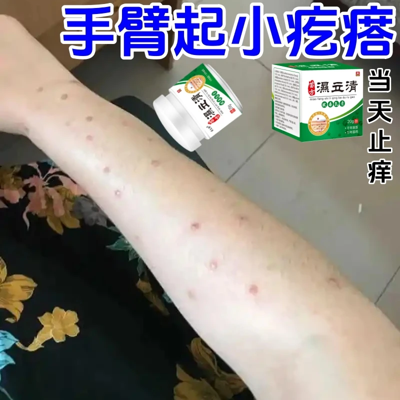 皮肤湿痒止痒季节性瘙痒红肿硬疙瘩全身痒起皮干痒草本外用乳膏