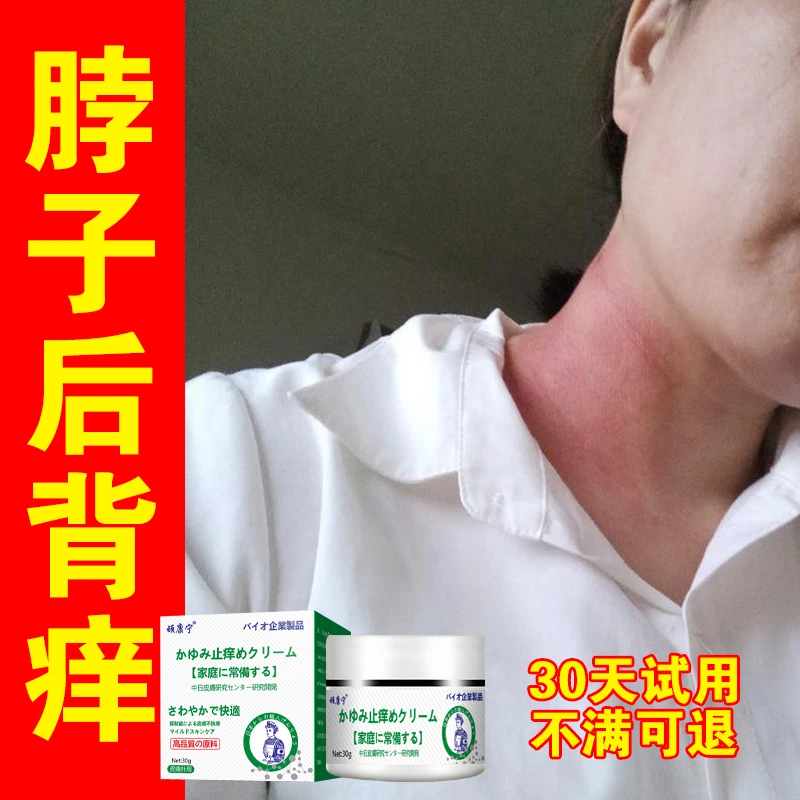 湿胗脖子红点疙瘩红痒渗液脱皮抓后背前胸全身止痒王外用涂抹膏