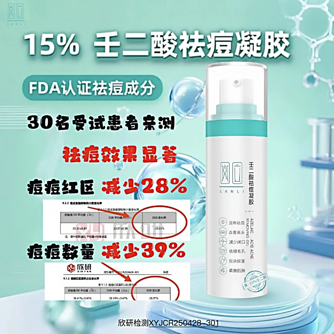 岚立15%壬二酸祛痘凝胶祛黑头粉刺保湿嫩肤收缩毛孔敏感肌通用