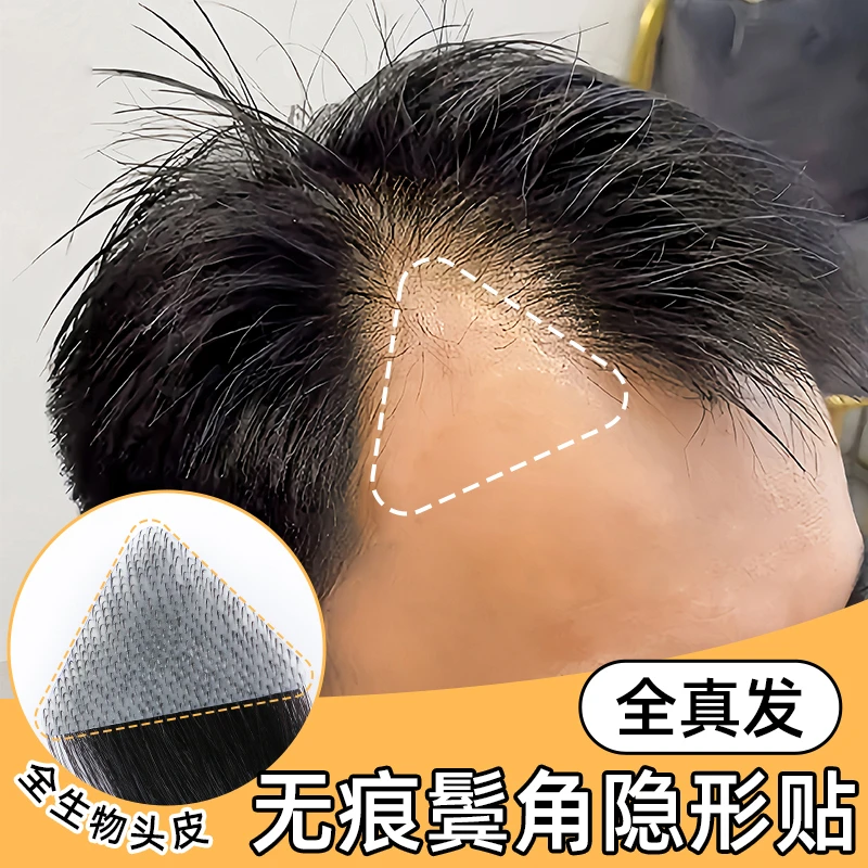发际线假发贴男前额M型补发全真人发假发片隐形无痕鬓角贴刘海片