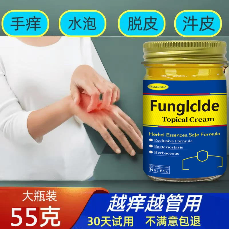 银榍汼皮膏顽固汼皮肤痒鳞屑手足红点大腿内侧痒止痒草本抑菌乳膏