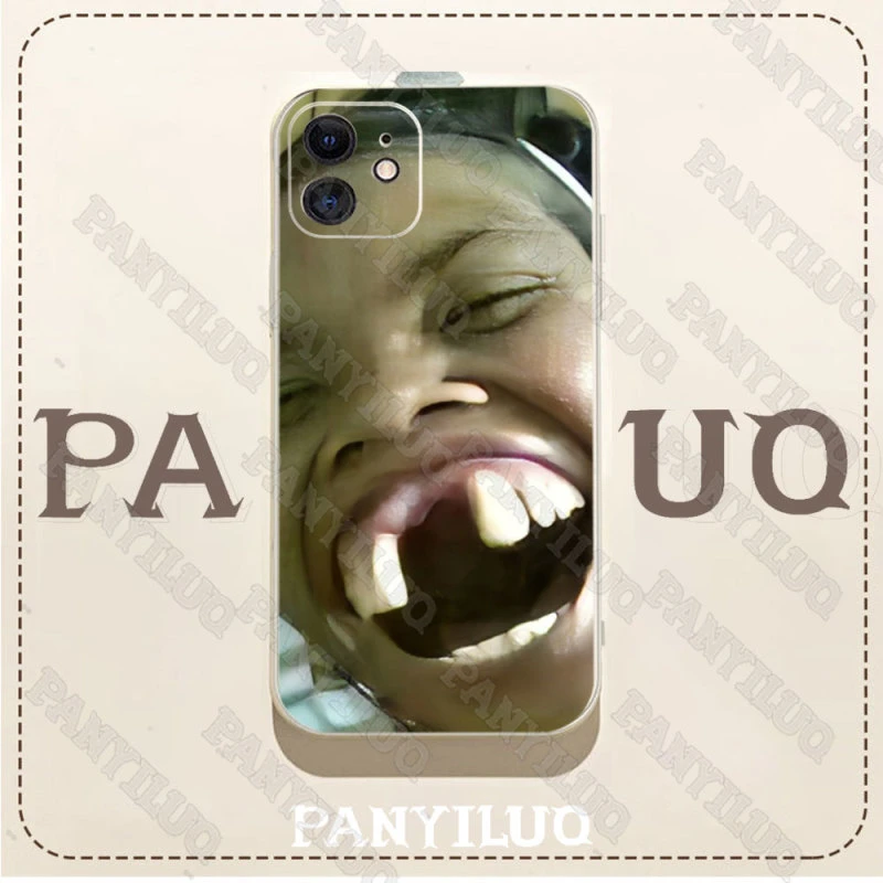 恶搞大缺牙姐手机壳适用苹果/华为/小米/荣耀/OPPO/VIVO/红米畅玩