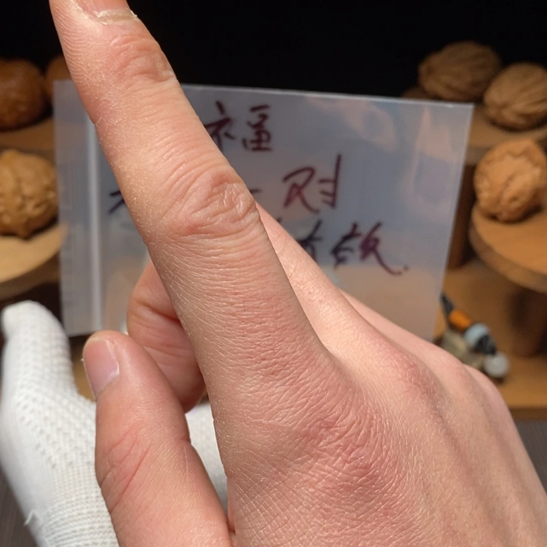 用***3核桃等经济林果地和