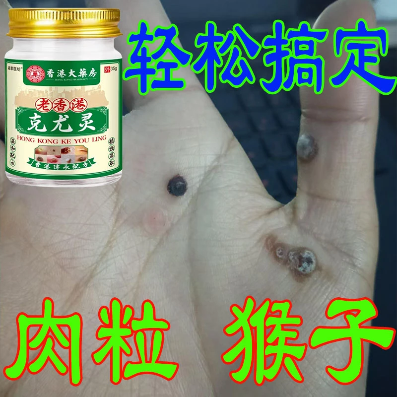 【小肉粒专用】老香港克尤灵去脖子肉粒手足腋下丝状扁平肉刺乳膏