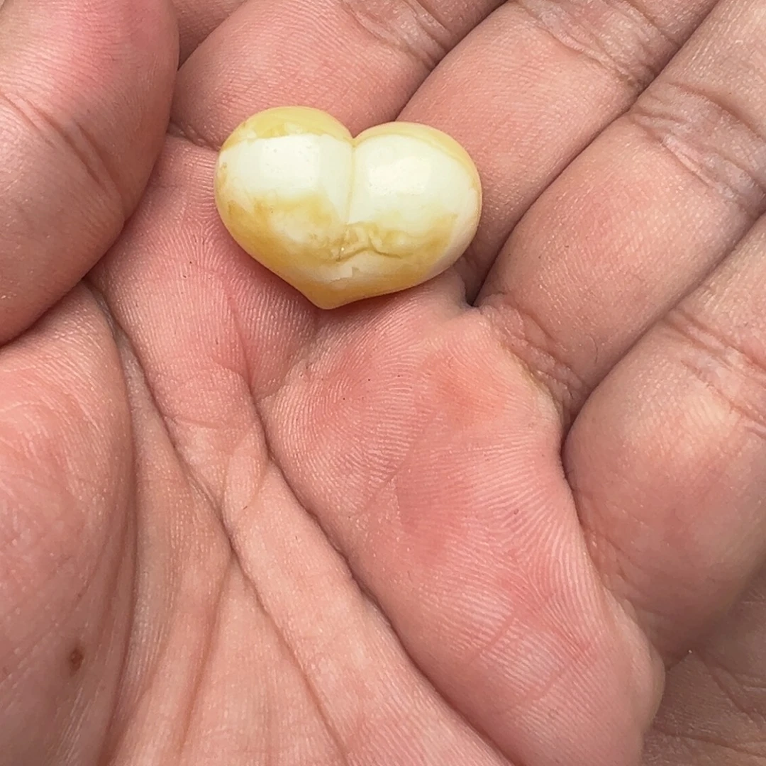 *****琥珀未镶嵌裸石瓷白花屁桃浓蜡
