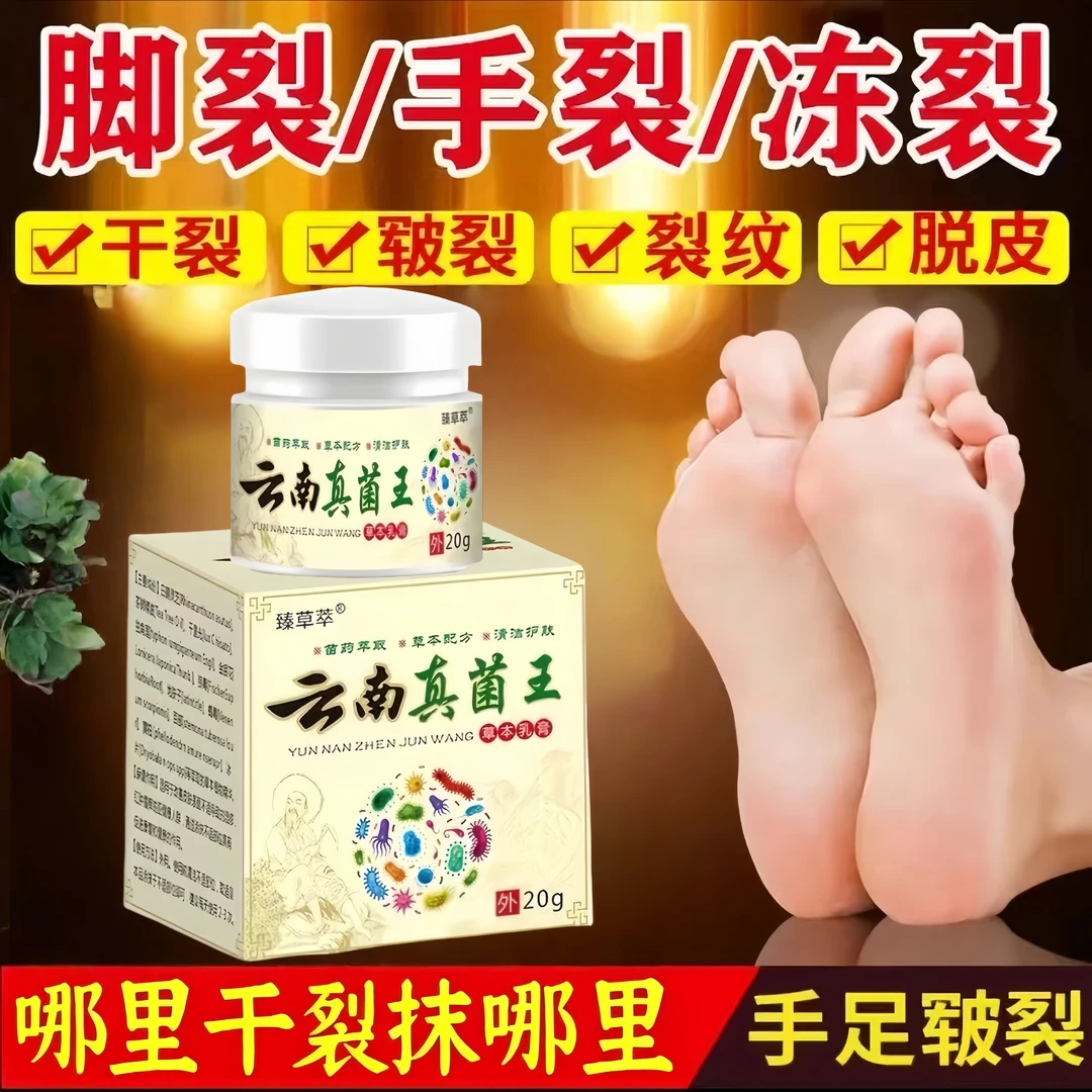 【冠军代言】真菌王全身止痒膏温和止痒抑菌干裂脱皮云南真菌王