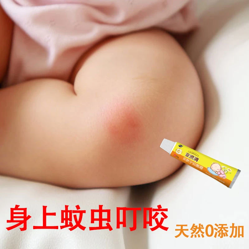 宝宝婴儿儿童止痒膏湿痒蚊虫叮咬皮肤过敏抑菌止痒专用舒缓软膏